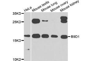 Western blot analysis of extracts of various cells, using B9D1 antibody. (B9D1 antibody)