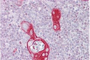 Immunohistochemistry with Thymus tissue at an antibody concentration of 5µg/ml using anti-FAIM antibody (ARP56237_P050) (FAIM antibody  (N-Term))