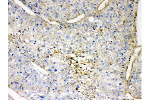 anti-Guanine Nucleotide Binding Protein (G Protein), beta Polypeptide 1 (GNB1) (AA 2-42), (N-Term) antibody