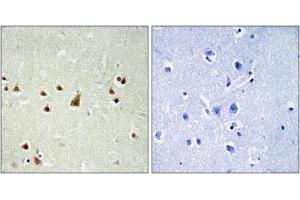 Immunohistochemistry analysis of paraffin-embedded human brain tissue using ANKRD26 antibody. (ANKRD26 antibody  (Internal Region))