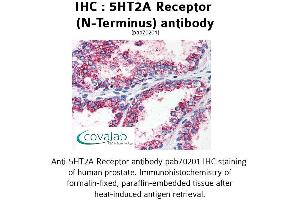 Image no. 1 for anti-5-Hydroxytryptamine (serotonin) Receptor 2A (HTR2A) (N-Term) antibody (ABIN1731362)