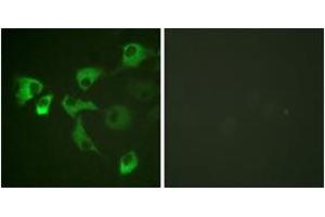 Immunofluorescence analysis of HuvEc cells, using eEF2 (Phospho-Thr56) Antibody. (EEF2 antibody  (pThr56))
