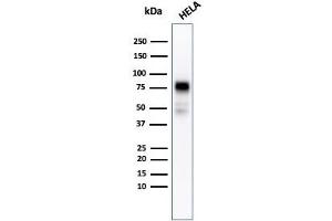 Western blot analysis of HeLa cell lysate using CD44 Recombinant Mouse Monoclonal Antibody (rHCAM/918). (Recombinant CD44 antibody)