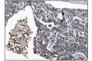IHC analysis of KMT1B/SUV39H2 using anti-KMT1B/SUV39H2 antibody (ABIN7602135). (SUV39H2 antibody  (AA 6-410))