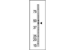 Western Blotting (WB) image for anti-Casein Kinase 2 alpha 1 (CSNK2A1) (Middle Region) antibody (ABIN360651) (CSNK2A1/CK II alpha antibody  (Middle Region))