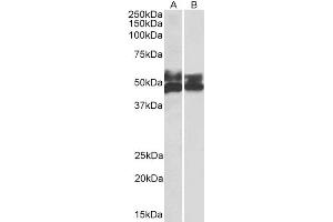 Western Blotting (WB) image for anti-Fc Receptor-Like 1 (FCRL1) antibody (ABIN5900721)