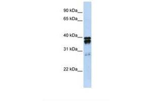 NUDT18 antibody  (N-Term)