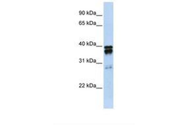 NUDT18 antibody  (N-Term)