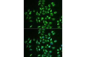 Immunofluorescence analysis of U2OS cell using LNX1 antibody. (LNX1 antibody)