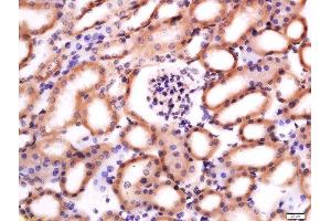 Paraformaldehyde-fixed, paraffin embedded mouse kidney, Antigen retrieval by boiling in sodium citrate buffer (pH6) for 15min, Block endogenous peroxidase by 3% hydrogen peroxide for 30 minutes, Blocking buffer (normal goat serum) at 37°C for 20min, Antibody incubation with Rabbit Anti-CH25H Polyclonal Antibody, Unconjugated  at 1:200 overnight at 4°C, followed by a conjugated secondary for 90 minutes and DAB staining. (CH25H antibody  (AA 1-100))