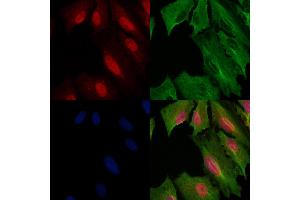 ABIN6259347 and ABIN6275551 staining  cells by IF/ICC. (PPP4R1L antibody  (C-Term))