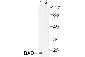Image no. 1 for anti-BCL2-Associated Agonist of Cell Death (BAD) antibody (ABIN265323) (BAD antibody)