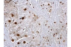 IHC-P Image hnRNP K antibody detects hnRNP K protein at nucleus on rat brain stem by immunohistochemical analysis. (HNRNPK antibody)