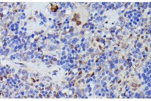 Immunohistochemistry of paraffin-embedded Rat spleen using CDC23 Polyclonal Antibody at dilution of 1:100 (40x lens).