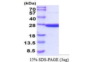 SDS-PAGE (SDS) image for Peroxiredoxin 2 (PRDX2) (AA 1-198) (Active) protein (His tag) (ABIN6388119)