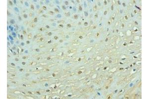Immunohistochemistry of paraffin-embedded human esophageal tissue using  at dilution of 1: 100