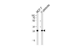 PRLR Antibody (Center) (ABIN1881684 and ABIN2843621) western blot analysis in MCF-7 cell line and human placenta tissue lysates (35 μg/lane). (Prolactin Receptor antibody  (AA 147-179))