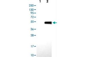 Western blot analysis of Lane 1: Negative control (vector only transfected HEK293T lysate) Lane 2: Over-expression lysate (Co-expressed with a C-terminal myc-DDK tag (~3. (Biglycan antibody)