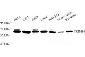 Western blot analysis of TRIM16 (ABIN7076012) at dilution of 1: 1000 (TRIM16 antibody)