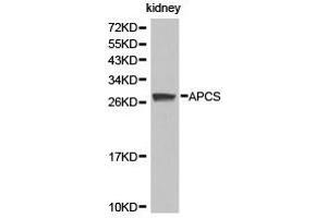 Western Blotting (WB) image for anti-Amyloid P Component, Serum (APCS) antibody (ABIN1871016) (APCS antibody)