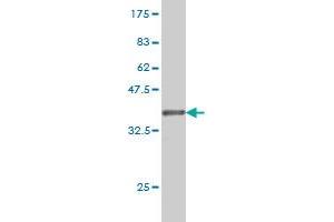 Western Blot detection against Immunogen (36. (KIFC1 antibody  (AA 53-152))