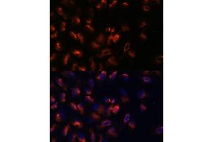 Immunofluorescence (IF) image for anti-Stromal Interaction Molecule 2 (Stim2) (AA 60-180) antibody (ABIN7270611)