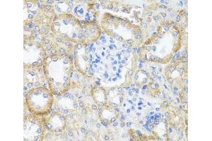 Immunohistochemistry of paraffin-embedded Mouse kidney using ASL Polyclonal Antibody at dilution of 1:100 (40x lens). (ASL antibody)
