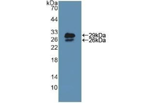 NUP85 antibody  (AA 418-653)