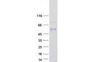serine Carboxypeptidase 1 (SCPEP1) protein (Myc-DYKDDDDK Tag)