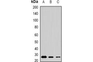 Western blot analysis of MSRB3 expression in mouse testis (A), mouse brain (B), rat lung (C) whole cell lysates. (MSRB3 antibody)