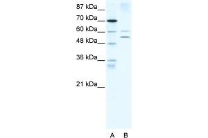 WB Suggested Anti-AIRE Antibody   Titration: 5 ug/ml   Positive Control: HepG2 Whole Cell (AIRE antibody  (N-Term))