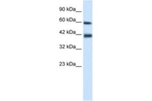 Western Blotting (WB) image for anti-Tripartite Motif Containing 31 (TRIM31) antibody (ABIN2461032)