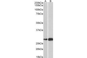 ABIN570906 (1µg/ml) staining of Mouse (A) and Rat (B) Skeletal Muscle lysate (35µg protein in RIPA buffer). (ATF5 antibody  (C-Term))