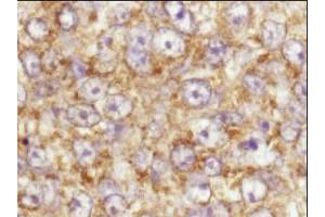 Immunohistochemistry. (AKT1 antibody  (C-Term))