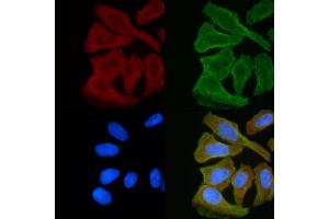 ABIN6255420 and ABIN6268978 staining Hela cells(30 min of UV treatment) by IF/ICC.