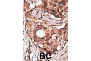 Immunohistochemistry (IHC) image for anti-Melanoma Antigen Family B, 2 (MAGEB2) antibody (ABIN3002533)