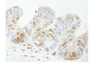 Immunohistochemistry (IHC) image for anti-Tyrosyl-DNA Phosphodiesterase 1 (TDP1) (AA 1-50) antibody (ABIN7448828)
