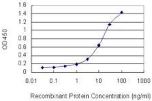 Detection limit for recombinant GST tagged ZNF274 is 0. (ZNF274 antibody  (AA 420-530))