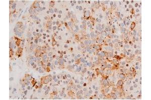 Immunohistochemistry (IHC) image for anti-GATA Binding Protein 4 (GATA4) (pSer262) antibody (ABIN6256227)