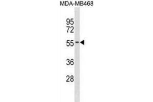 Western Blotting (WB) image for anti-Potassium Channel Subfamily K Member 6 (KCNK6) antibody (ABIN3001021)