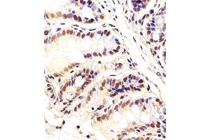 Immunohistochemical analysis of paraffin-embedded M. (CTR9 antibody  (C-Term))