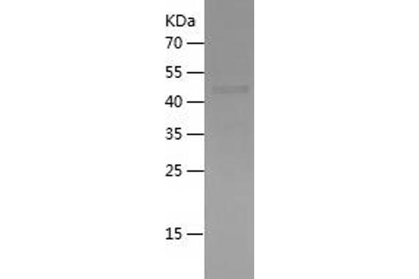 IL-6 Receptor Protein (AA 229-468) (His-IF2DI Tag)