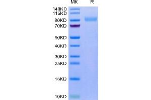LRRN1 Protein (AA 26-631) (His tag)