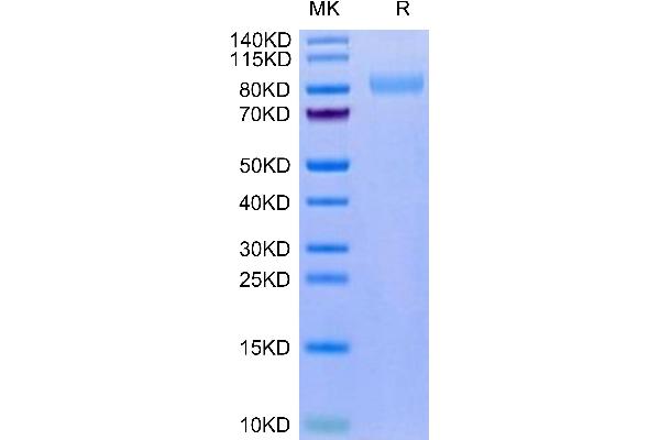 LRRN1 Protein (AA 26-631) (His tag)