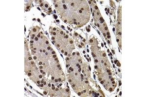 Immunohistochemistry of paraffin-embedded human stomach using GPS1 antibody at dilution of 1:100 (x400 lens). (GPS1 antibody)