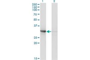 Western Blot analysis of CDK2 expression in transfected 293T cell line by CDK2 monoclonal antibody (M01A), clone 3A2-3G6.