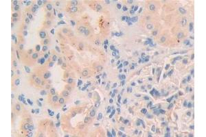 DAB staining on IHC-P; Samples: Human Kidney Tissue (Myosin IC antibody  (AA 765-1011))