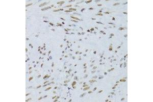 Immunohistochemistry (Paraffin-embedded Sections) (IHC (p)) image for anti-Nuclear Factor of kappa Light Polypeptide Gene Enhancer in B-Cells 2 (NFKB2) (AA 690-899) antibody (ABIN3017388)