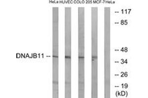 Western blot analysis of extracts from HeLa/HuvEc/COLO/MCF-7 cells, using DNAJB11 Antibody. (DNAJB11 antibody  (AA 31-80))