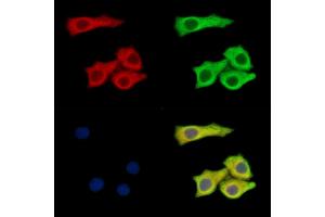 ABIN7095172 and ABIN7099228 staining Hela cells by IF/ICC. (SLC35B1 antibody)